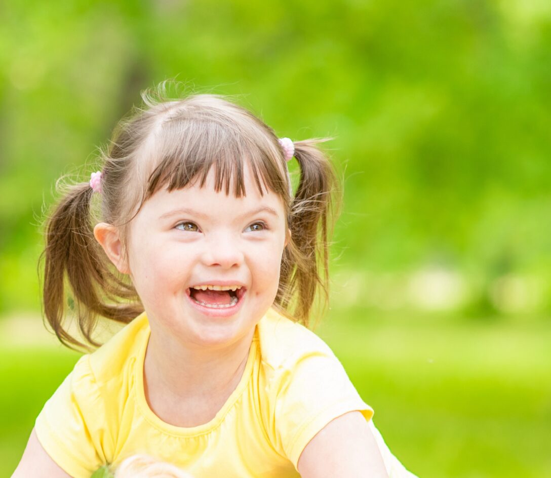 Portrait of a joyful little girl with syndrome down in a summer