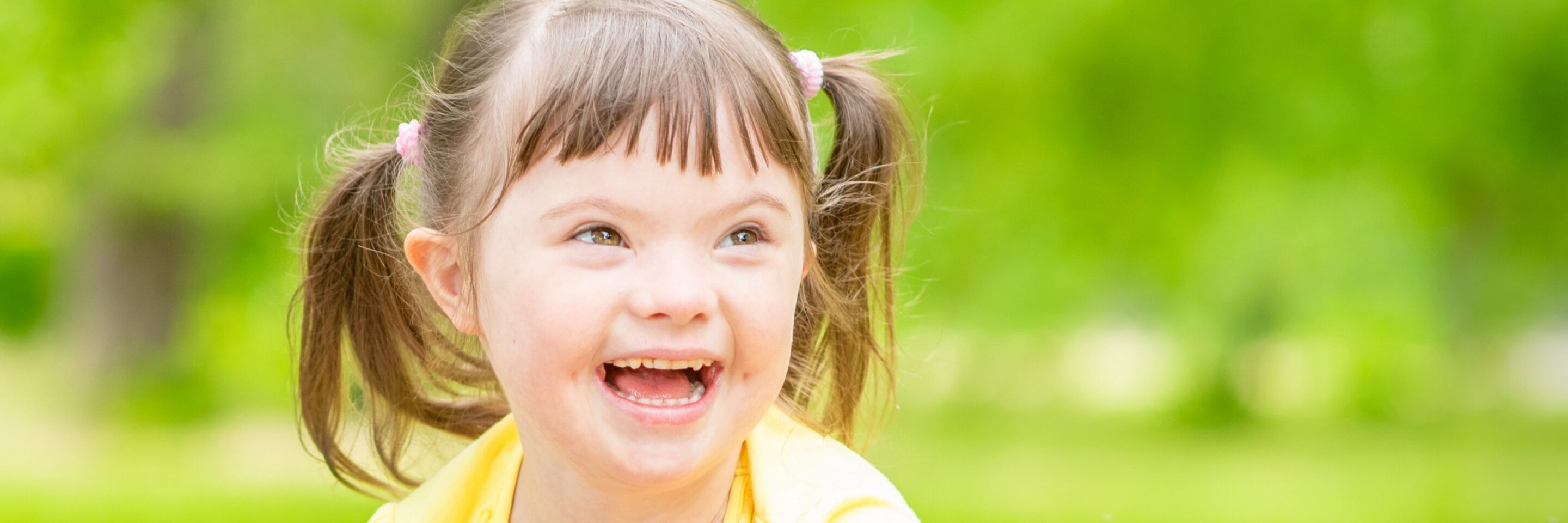 Portrait of a joyful little girl with syndrome down in a summer